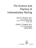 The Science and Practice of Intramedullary Nailing