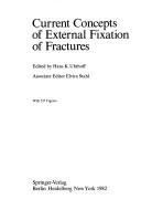 Current Concepts of External Fixation of Fractures