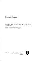 Crohn's disease