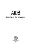 AIDS
