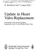Update in Heart Valve Replacement