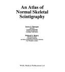 An Atlas of Normal Skeletal Scintigraphy