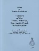 Tumors of the testis, adnexa, spermatic cord, and scrotum