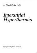 Interstitial Hyperthermia