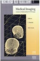 Medical Imaging, Analysis of Multimodality 2D/3D Images