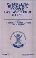 Placental And Endometrial Proteins: Basic And Clinical Aspects