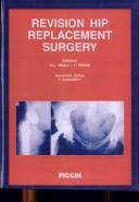 Revision Hip Replacement Surgery
