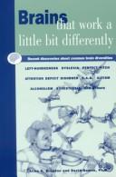 Brains That Work a Little Bit Differently