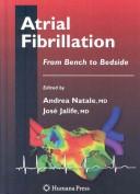 Atrial Fibrillation