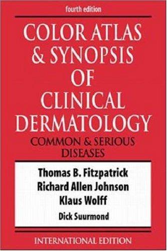 Color Atlas and Synopsis of Clinical Dermatology
