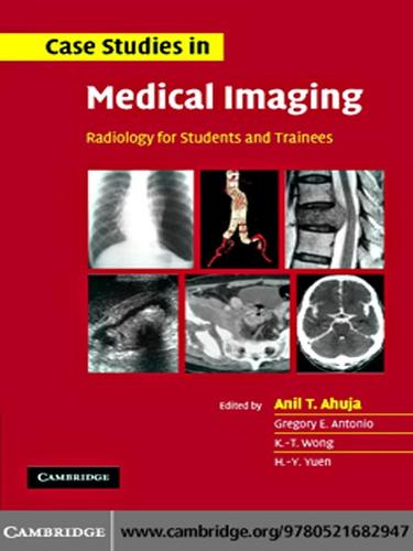 Case Studies in Medical Imaging