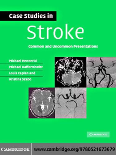 Case Studies in Stroke