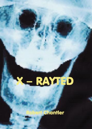 X-Rayted