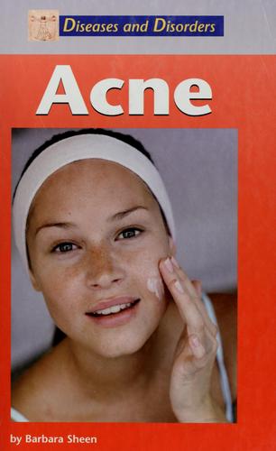 Acne