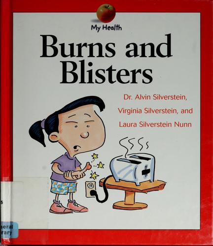 Burns and Blisters