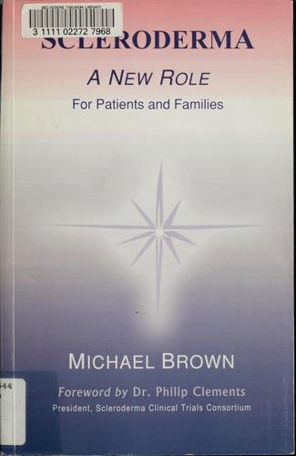 Scleroderma