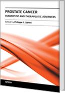 Prostate Cancer - Diagnostic and Therapeutic Advances