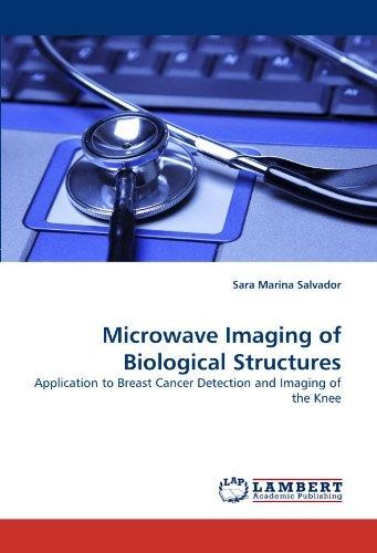 Microwave Imaging of Biological Structures: Application to Breast Cancer Detection and Imaging of the Knee
