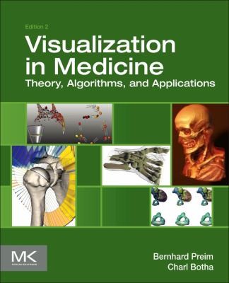 Visual Computing for Medicine: Theory, Algorithms, and Applications