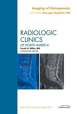 Imaging of Osteoporosis