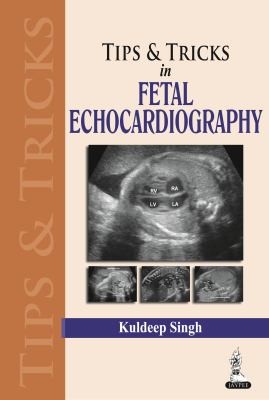Tips and Tricks in Fetal Echocardiography