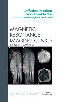 Clinical Applications of Diffusion Imaging