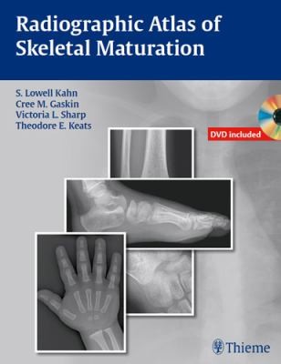 Radiographic Atlas of Skeletal Maturation