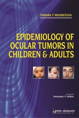 Epidemiology of Ocular Tumors in Children and Adults