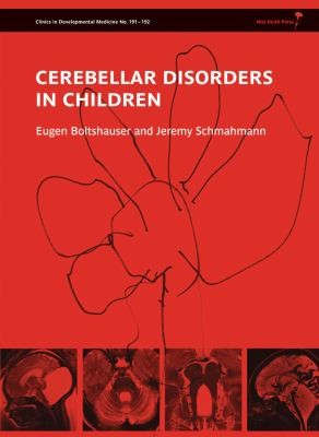 Cerebellar Disorders in Children
            
                Clinics in Developmental Medicine