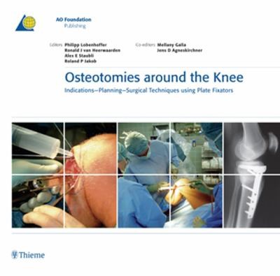 Osteotomies Around the Knee
