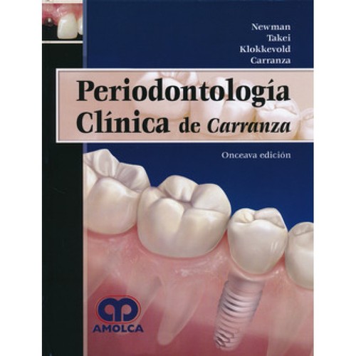 Carranza's Clinical Periodontology