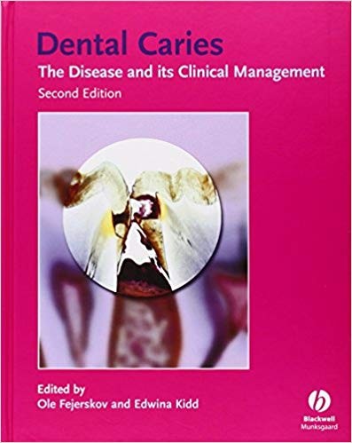 Dental caries : the disease and its clinical management - 2. ed.