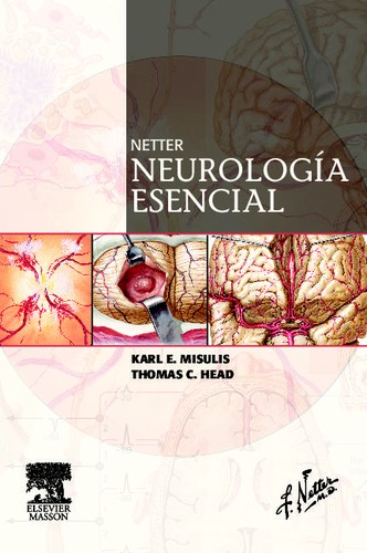 Netter. Neurologia esencial