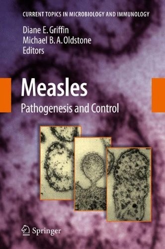Measles: Pathogenesis and Control (Current Topics in Microbiology and Immunology Book 330)
