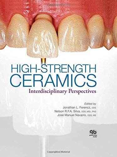 High-Strength Ceramics: A Collaboration of Science, Industry, Clinical, and Laboratory Expertise
