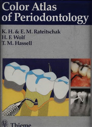 Color Atlas of Periodontology