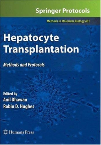 Hepatocyte transplantation