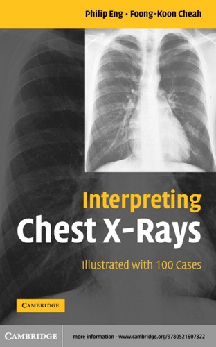 Interpreting Chest X-Rays: Illustrated with 100 Cases