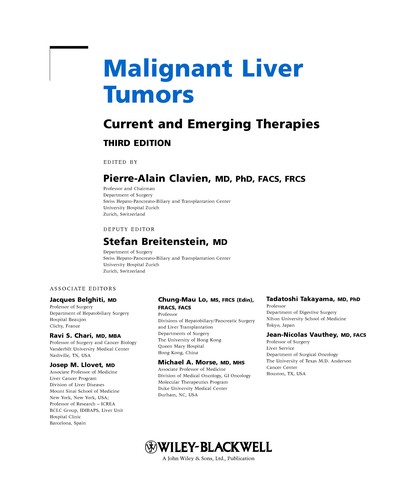 Malignant Liver Tumors