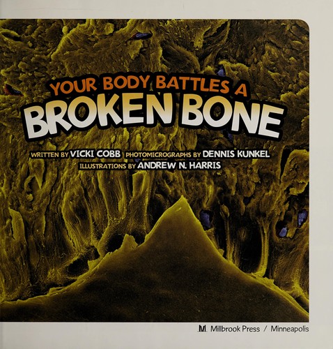 My Broken Bone