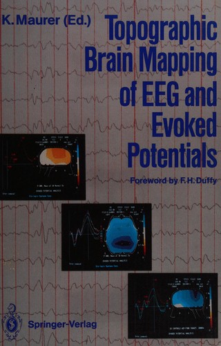 Topographic brain mapping of EEG and evoked potentials
