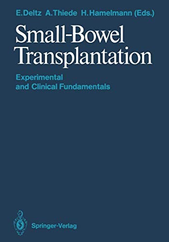 Small-bowel transplantation