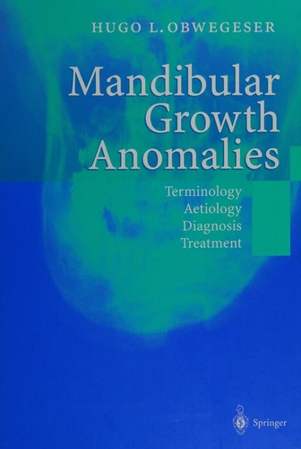 Mandibular Growth Anomalies