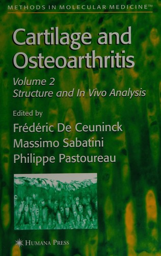 Cartilage and Osteoarthritis