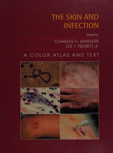 The Skin and Infection