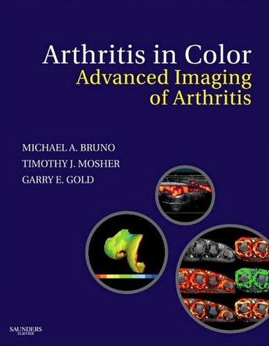 Arthritis in color