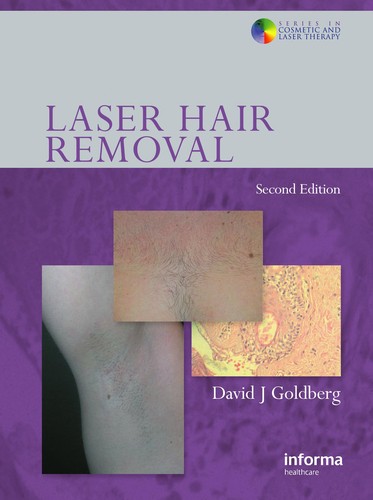 Laser Hair Removal