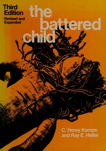 The Battered Child
