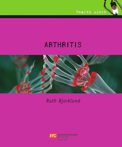 Arthritis