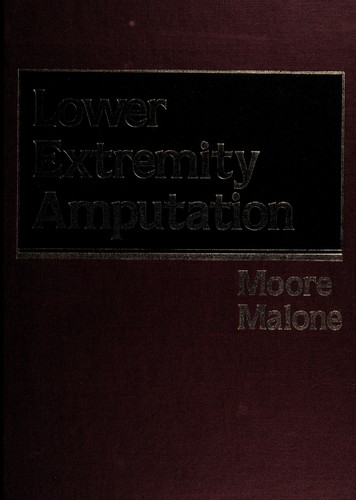 Lower extremity amputation